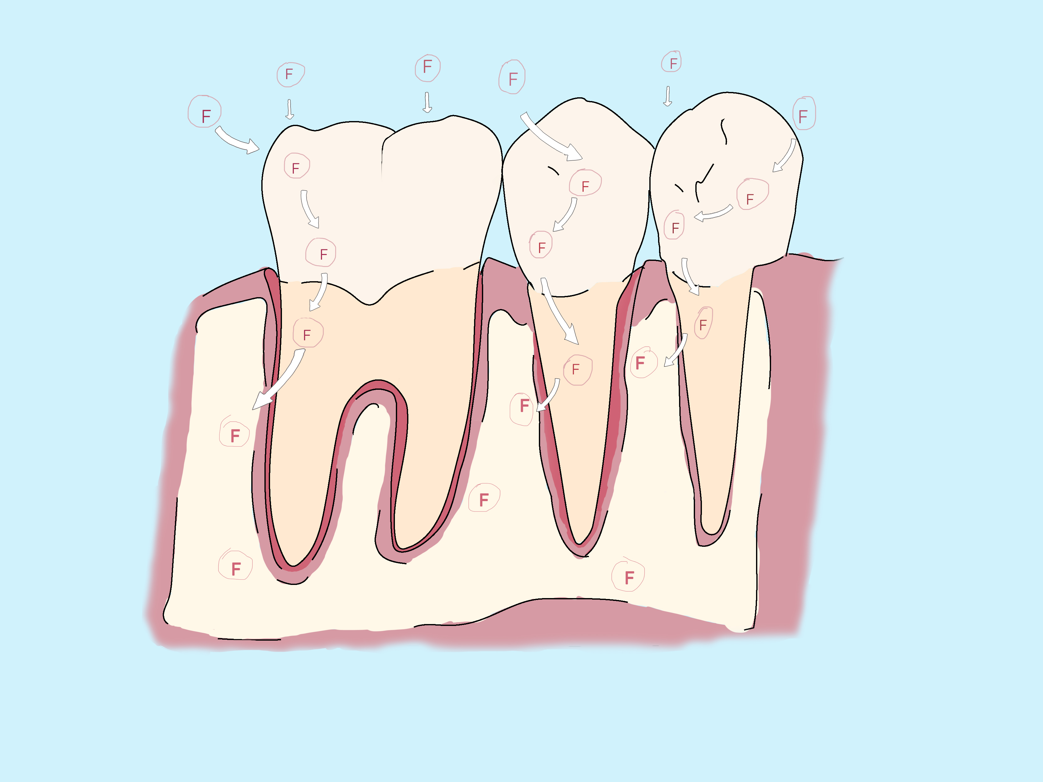 картинки болезни зубов